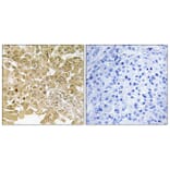 Immunohistochemistry - Anti-MEK1 Antibody (B7148) - Antibodies.com