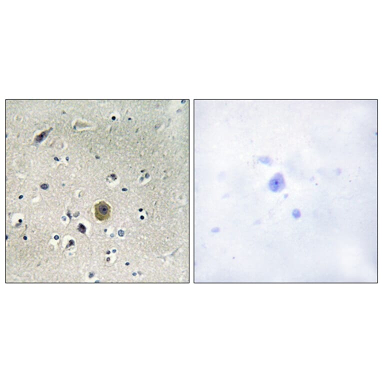 Immunohistochemistry - Anti-MEK1 Antibody (B0680) - Antibodies.com