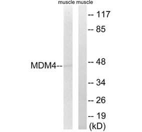 Western Blot - Anti-MDM4 Antibody (B8369) - Antibodies.com