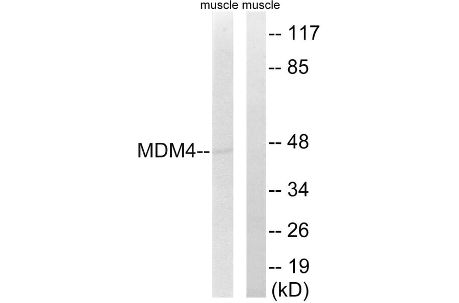 Western Blot - Anti-MDM4 Antibody (B8369) - Antibodies.com