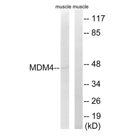 Western Blot - Anti-MDM4 Antibody (B8369) - Antibodies.com