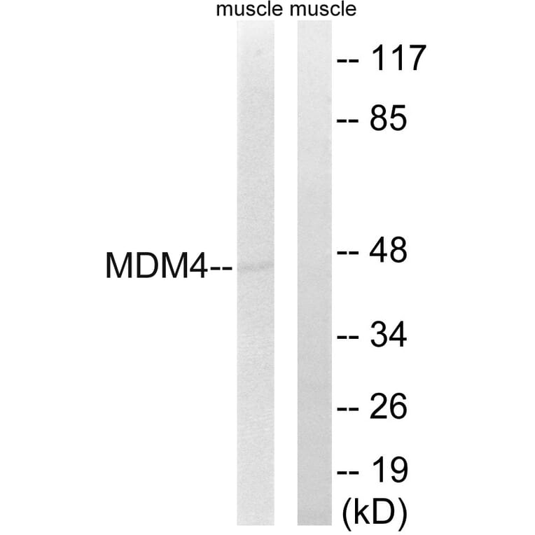 Western Blot - Anti-MDM4 Antibody (B8369) - Antibodies.com