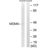 Western Blot - Anti-MDM4 Antibody (B8369) - Antibodies.com