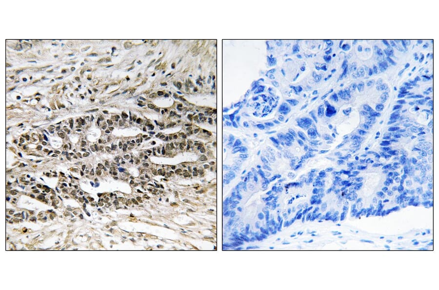 Immunohistochemistry - Anti-MDM4 Antibody (B8369) - Antibodies.com