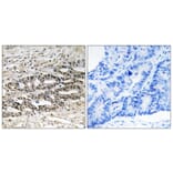 Immunohistochemistry - Anti-MDM4 Antibody (B8369) - Antibodies.com
