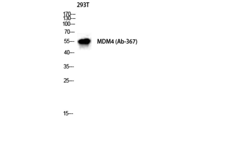 Western Blot - Anti-MDM4 Antibody (B8369) - Antibodies.com