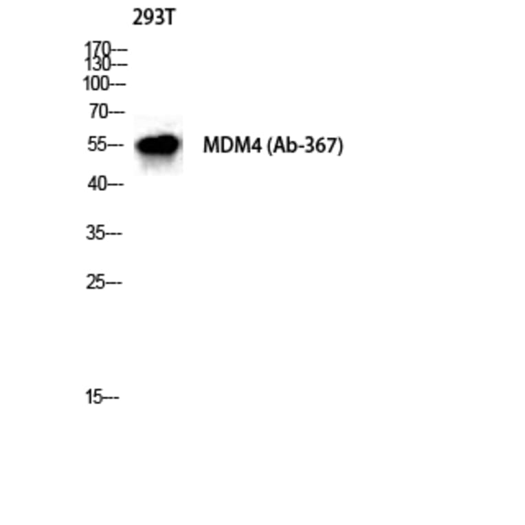 Western Blot - Anti-MDM4 Antibody (B8369) - Antibodies.com