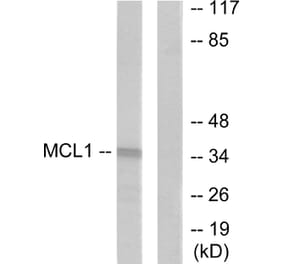 Western Blot - Anti-MCL1 Antibody (C0258) - Antibodies.com