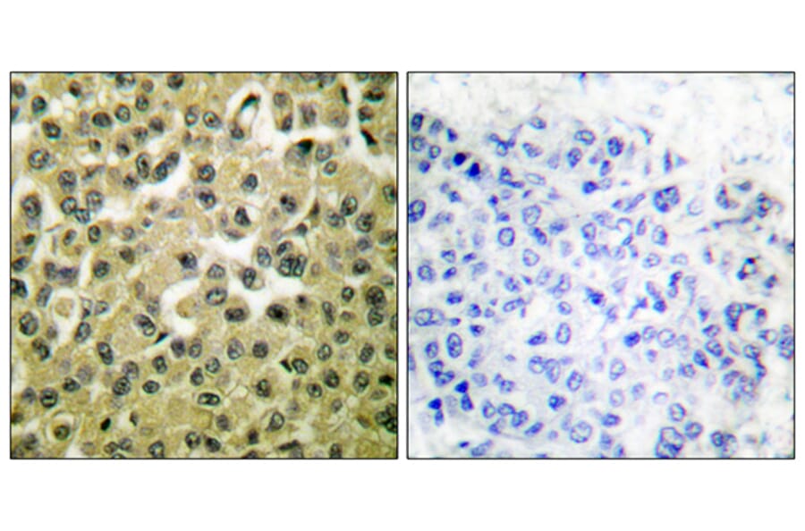 Immunohistochemistry - Anti-MCL1 Antibody (C0258) - Antibodies.com