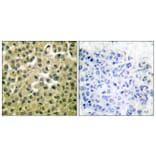 Immunohistochemistry - Anti-MCL1 Antibody (C0258) - Antibodies.com