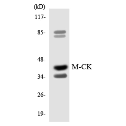 Western Blot - Anti-M-CK Antibody (R12-3006) - Antibodies.com