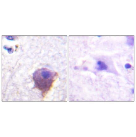 Immunohistochemistry - Anti-MAP4 Antibody (B1092) - Antibodies.com