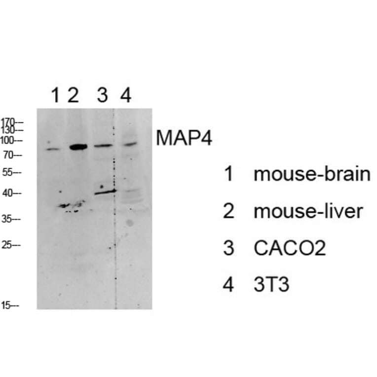Western Blot - Anti-MAP4 Antibody (B1092) - Antibodies.com