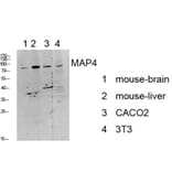 Western Blot - Anti-MAP4 Antibody (B1092) - Antibodies.com
