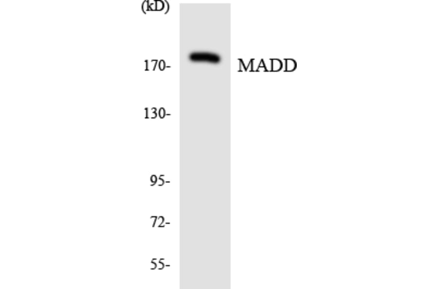 Western Blot - Anti-MADD Antibody (R12-2984) - Antibodies.com
