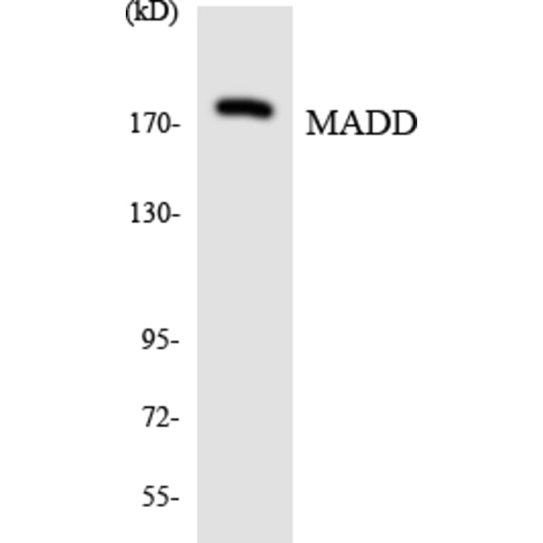 Western Blot - Anti-MADD Antibody (R12-2984) - Antibodies.com