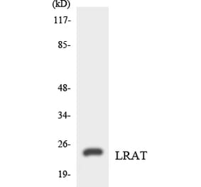 Western Blot - Anti-LRAT Antibody (R12-2976) - Antibodies.com