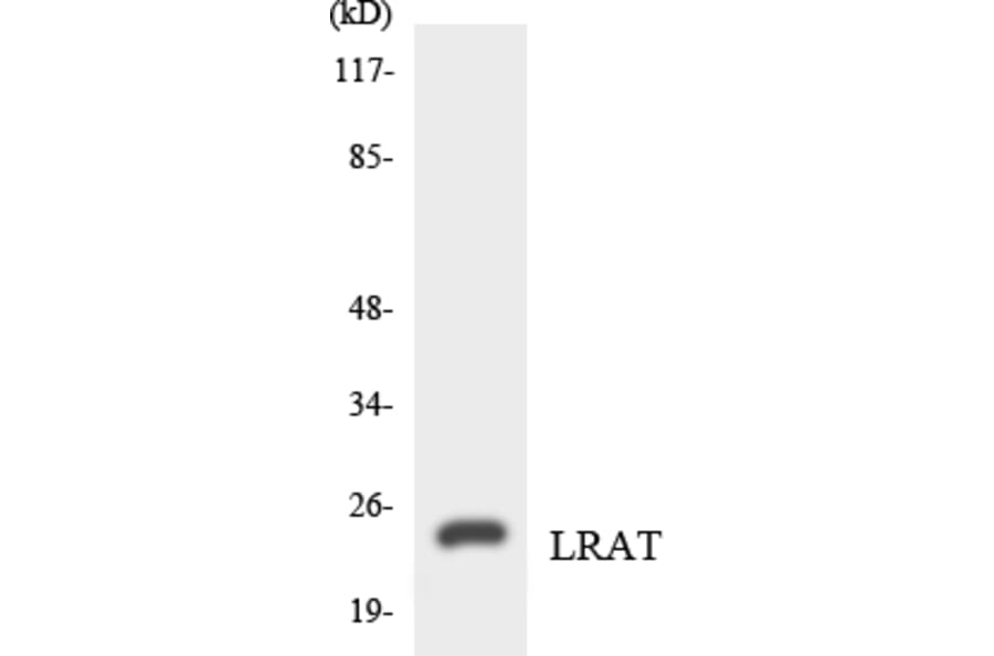 Western Blot - Anti-LRAT Antibody (R12-2976) - Antibodies.com