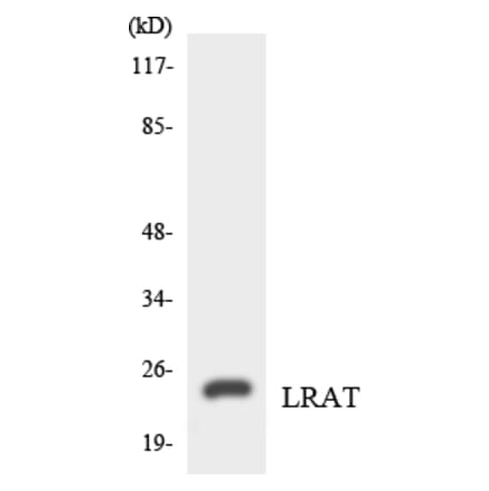 Western Blot - Anti-LRAT Antibody (R12-2976) - Antibodies.com