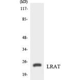 Western Blot - Anti-LRAT Antibody (R12-2976) - Antibodies.com