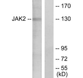 Western Blot - Anti-JAK2 Antibody (B7126) - Antibodies.com