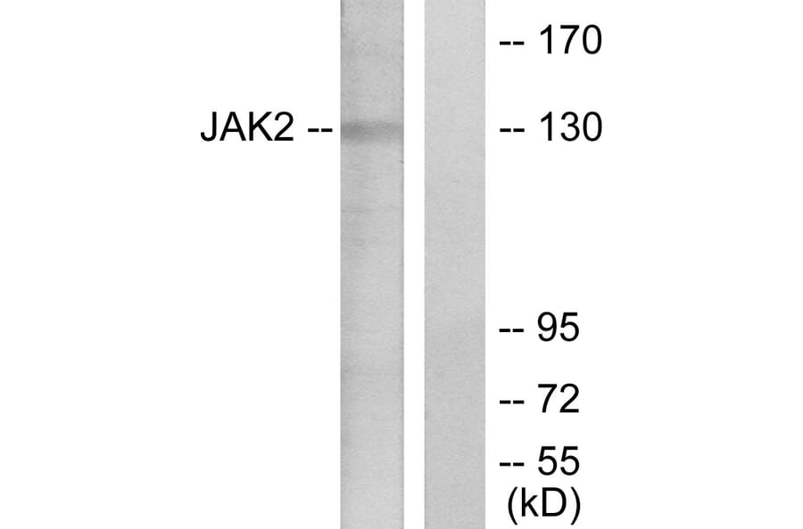 Western Blot - Anti-JAK2 Antibody (B7126) - Antibodies.com