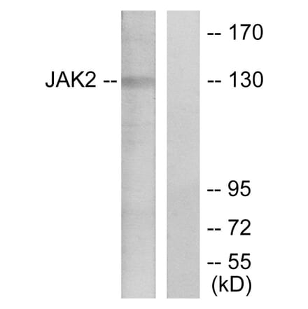 Western Blot - Anti-JAK2 Antibody (B7126) - Antibodies.com