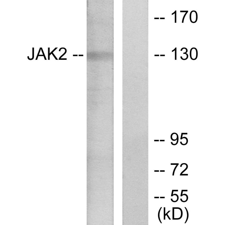 Western Blot - Anti-JAK2 Antibody (B7126) - Antibodies.com