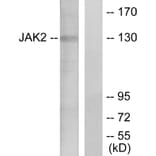 Western Blot - Anti-JAK2 Antibody (B7126) - Antibodies.com