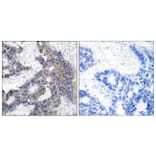 Immunohistochemistry - Anti-JAK2 Antibody (B7126) - Antibodies.com