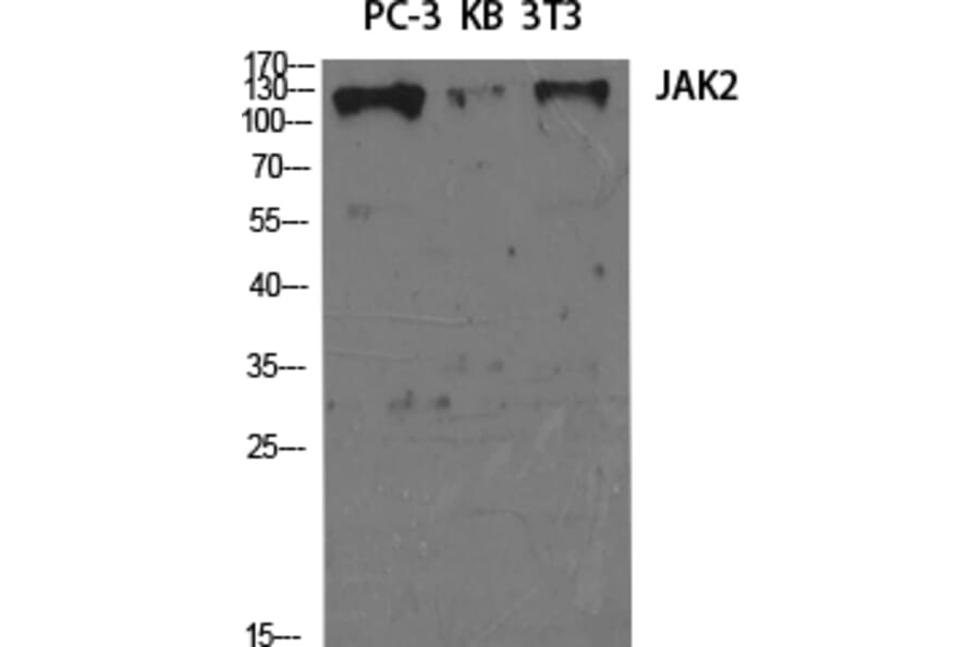 Western Blot - Anti-JAK2 Antibody (B7126) - Antibodies.com