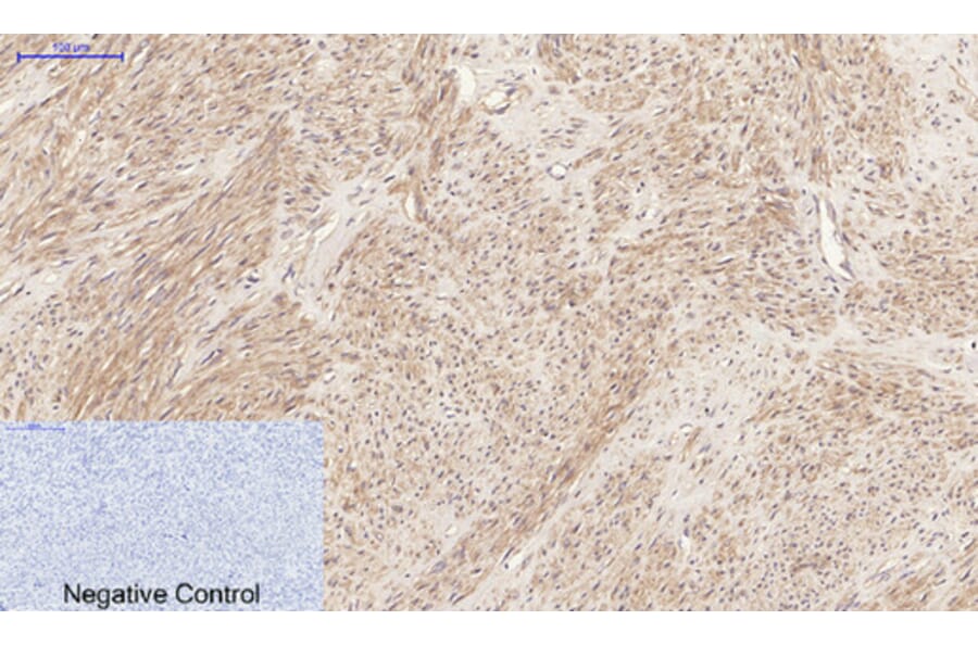 Immunohistochemistry - Anti-JAK2 Antibody (B7126) - Antibodies.com