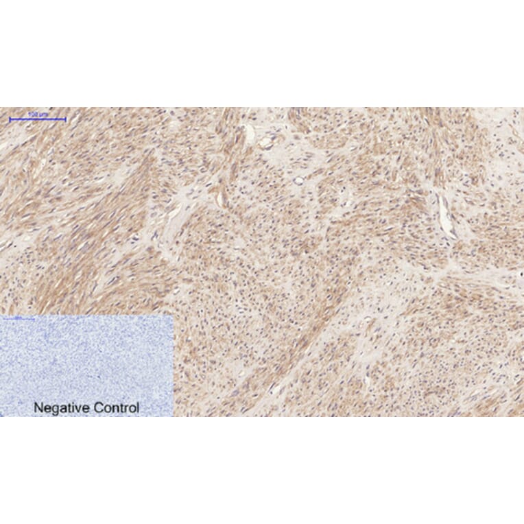 Immunohistochemistry - Anti-JAK2 Antibody (B7126) - Antibodies.com