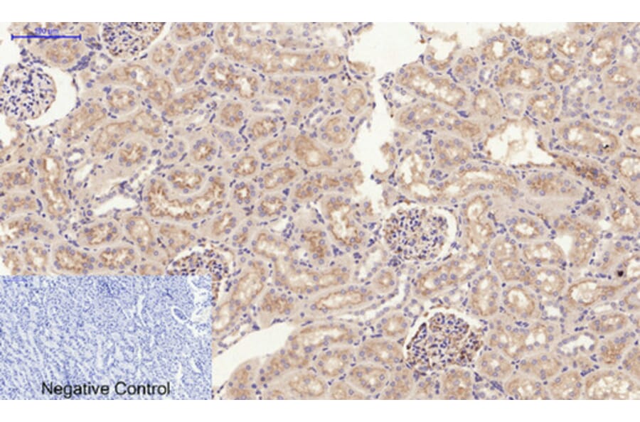 Immunohistochemistry - Anti-JAK2 Antibody (B7126) - Antibodies.com