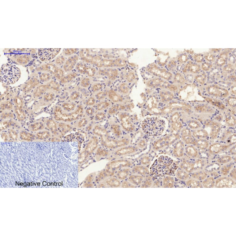 Immunohistochemistry - Anti-JAK2 Antibody (B7126) - Antibodies.com