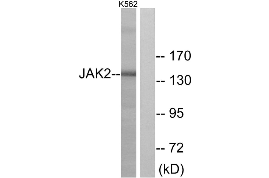 Western Blot - Anti-JAK2 Antibody (B7127) - Antibodies.com