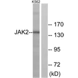 Western Blot - Anti-JAK2 Antibody (B7127) - Antibodies.com