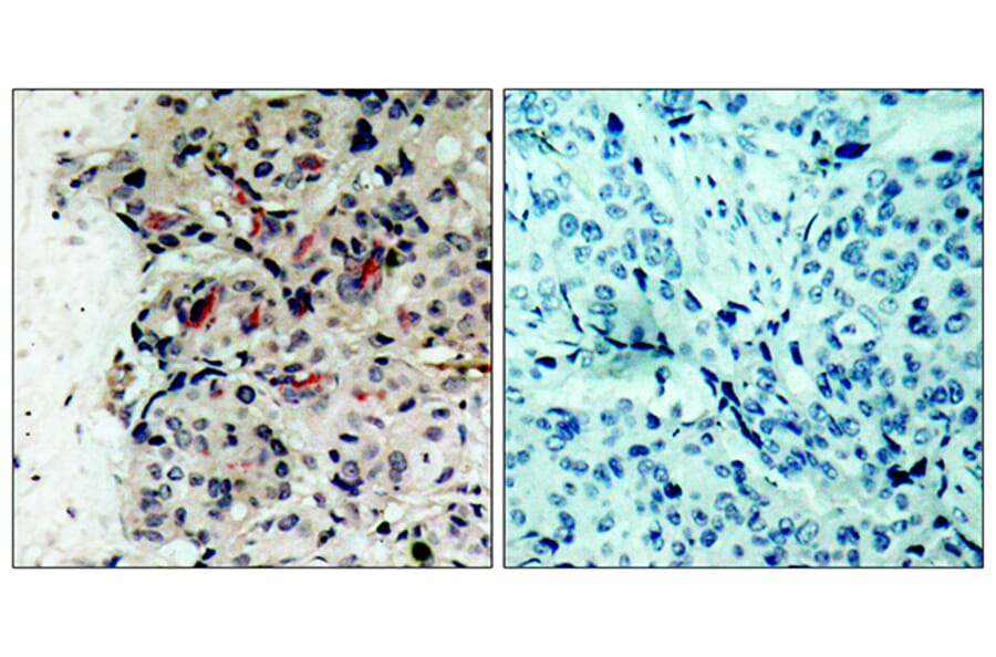 Immunohistochemistry - Anti-JAK1 Antibody (B7125) - Antibodies.com