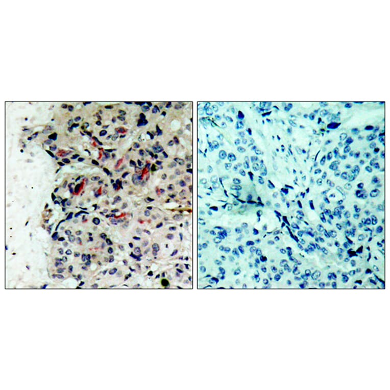 Immunohistochemistry - Anti-JAK1 Antibody (B7125) - Antibodies.com