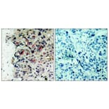 Immunohistochemistry - Anti-JAK1 Antibody (B7125) - Antibodies.com