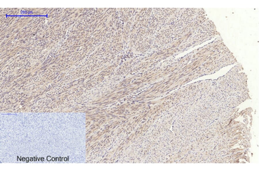 Immunohistochemistry - Anti-JAK1 Antibody (B7125) - Antibodies.com
