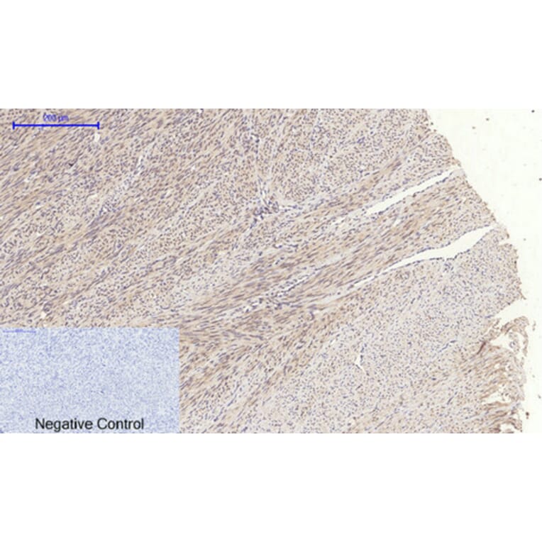 Immunohistochemistry - Anti-JAK1 Antibody (B7125) - Antibodies.com