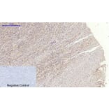 Immunohistochemistry - Anti-JAK1 Antibody (B7125) - Antibodies.com