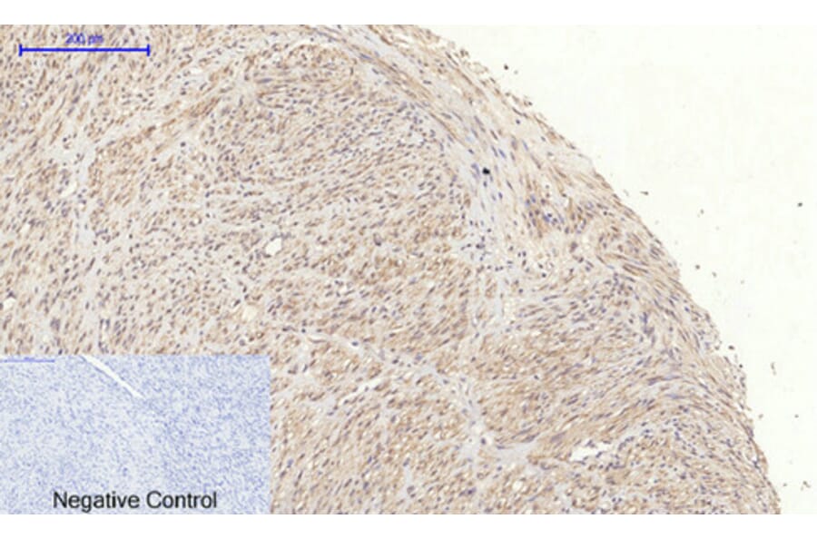 Immunohistochemistry - Anti-JAK1 Antibody (B7125) - Antibodies.com