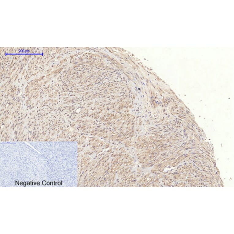Immunohistochemistry - Anti-JAK1 Antibody (B7125) - Antibodies.com
