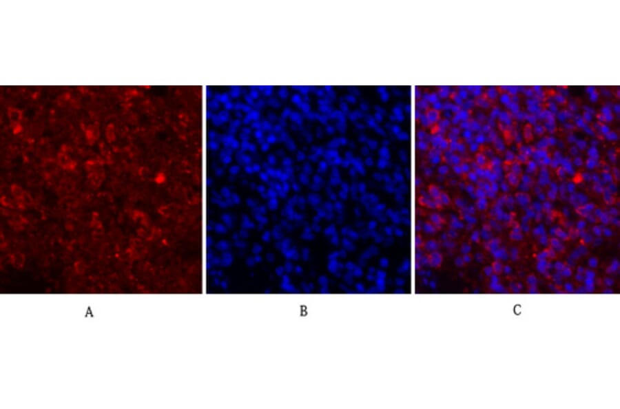 Immunofluorescence - Anti-JAK1 Antibody (B7125) - Antibodies.com