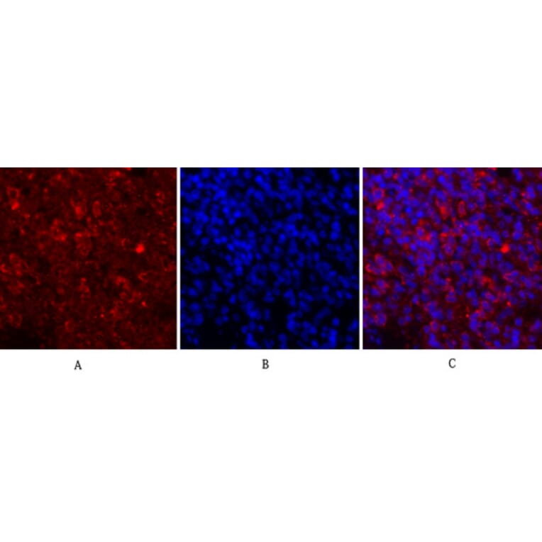 Immunofluorescence - Anti-JAK1 Antibody (B7125) - Antibodies.com
