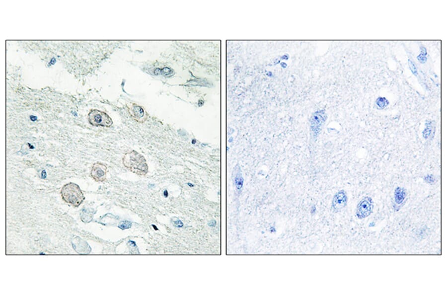 Immunohistochemistry - Anti-JAK1 Antibody (C10459) - Antibodies.com