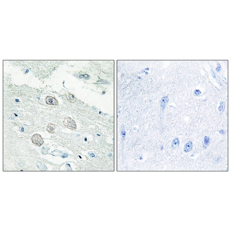 Immunohistochemistry - Anti-JAK1 Antibody (C10459) - Antibodies.com