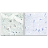 Immunohistochemistry - Anti-JAK1 Antibody (C10459) - Antibodies.com